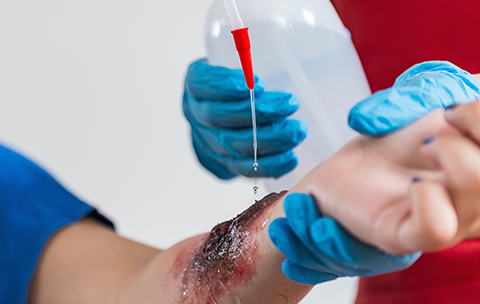 MULTIEMERGENCIAS-CURSO-ATENCION-PACIENTE-QUEMADO