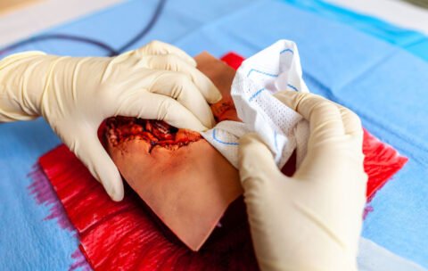 Stop-the-bleed